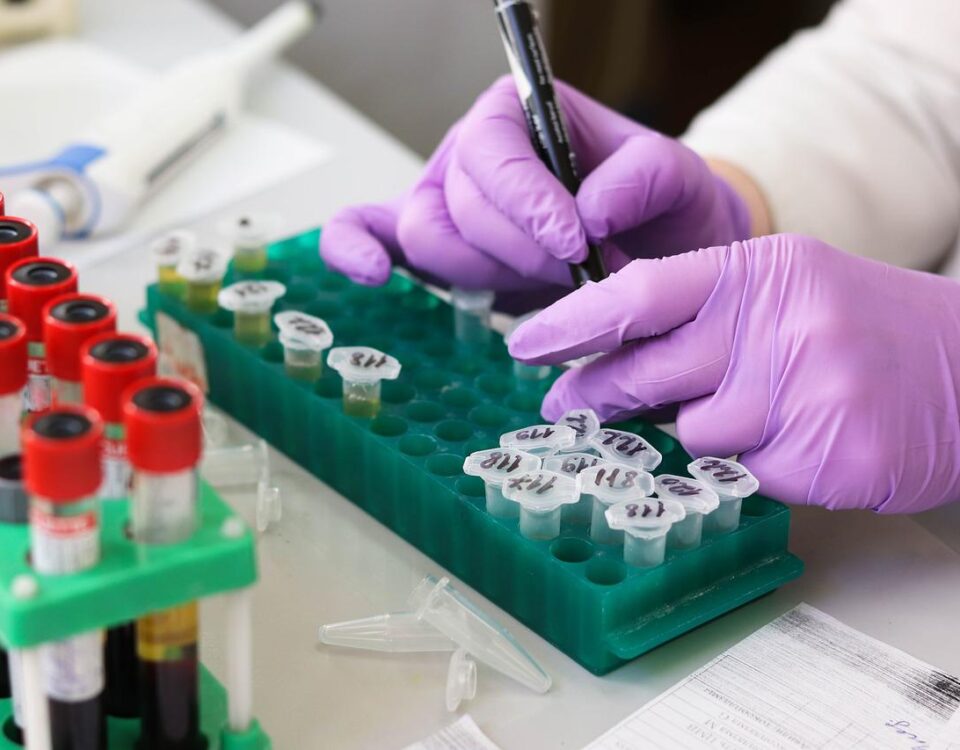 Preparazione di campioni biologici durante un'attività di ricerca scientifica in laboratorio da parte di un professionista sanitario.